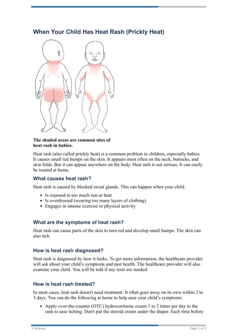 Heat Rash Kids Rfch Text - When Your Child Has Heat Rash (Prickly Heat) - HealthClips Online