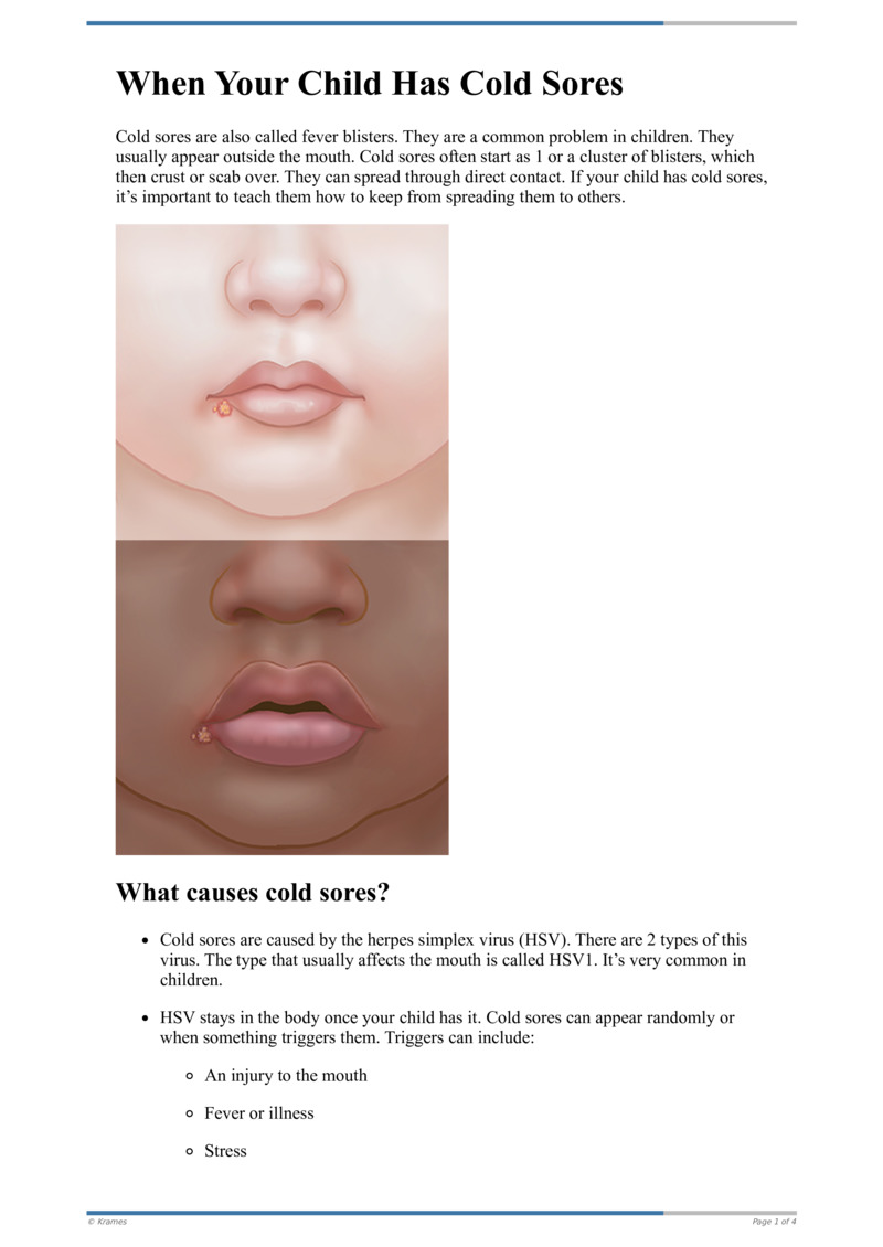 Text When Your Child Has Cold Sores HealthClips Online