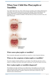 Thumbnail image for "When Your Child Has Pharyngitis or Tonsillitis"