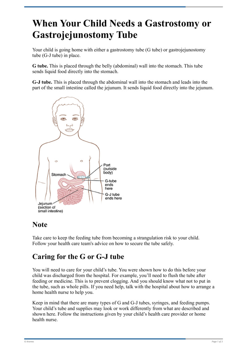 Text When Your Child Needs a Gastrostomy or Gastrojejunum Tube