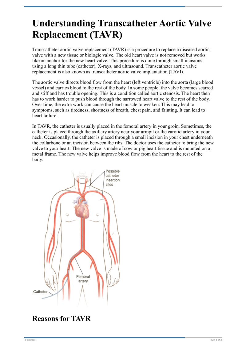 Text Understanding Transcatheter Aortic Valve Replacement (TAVR