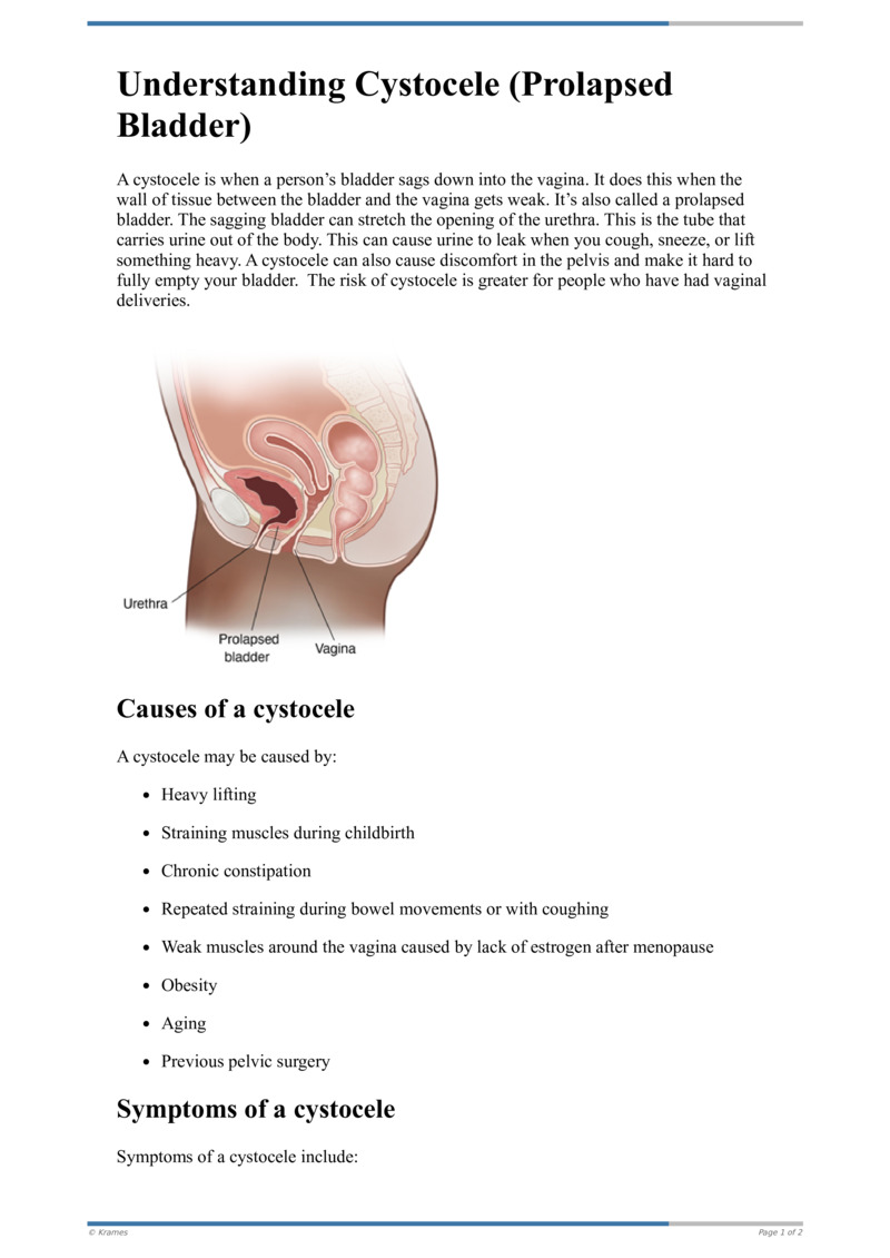 Understanding Cystocele (Prolapsed Bladder)