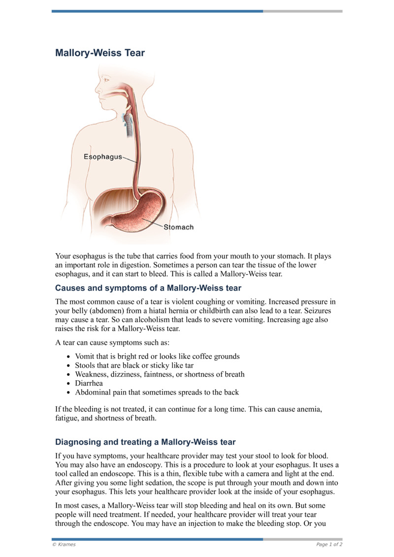 PDF MalloryWeiss Tear HealthClips Online
