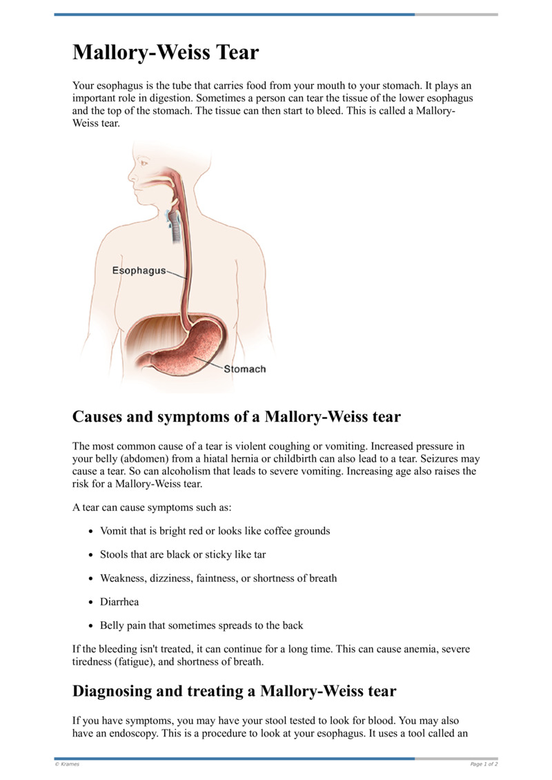 Text MalloryWeiss Tear HealthClips Online