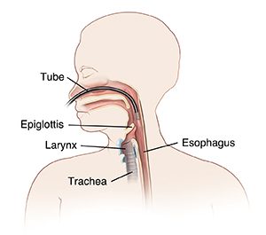 Text - Understanding Fiberoptic Evaluation of Swallowing (FEES ...