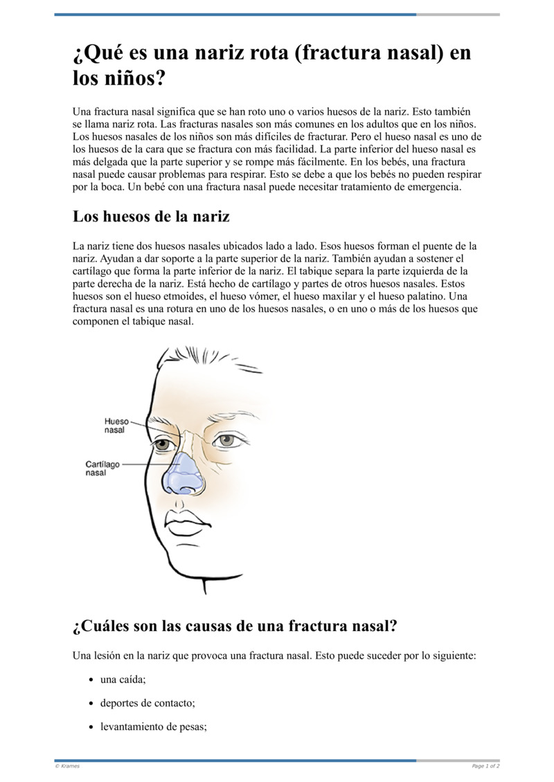 Text - ¿Qué es una nariz rota (fractura nasal) en los niños ...
