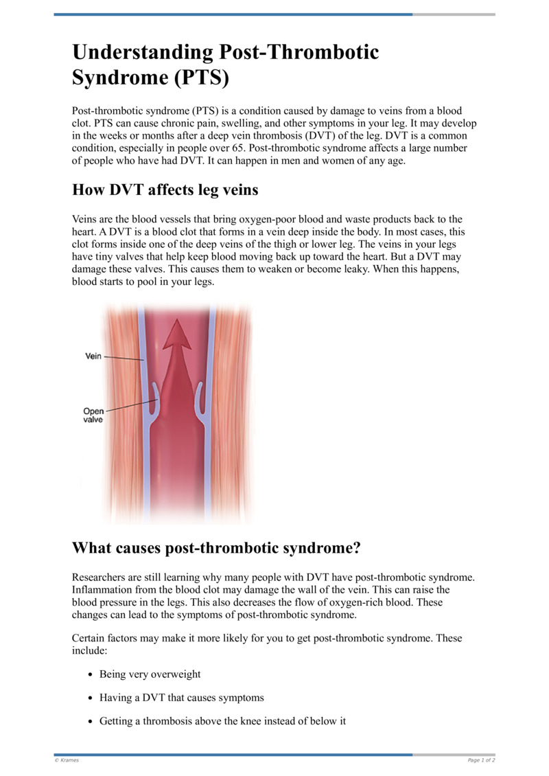 Text - Understanding Post-Thrombotic Syndrome (PTS) - HealthClips Online