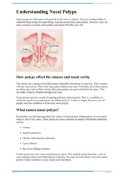 Thumbnail image for "Understanding Nasal Polyps"