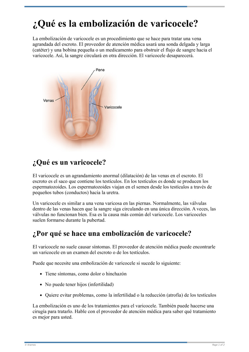 Text - ¿Qué es la embolización de varicocele?