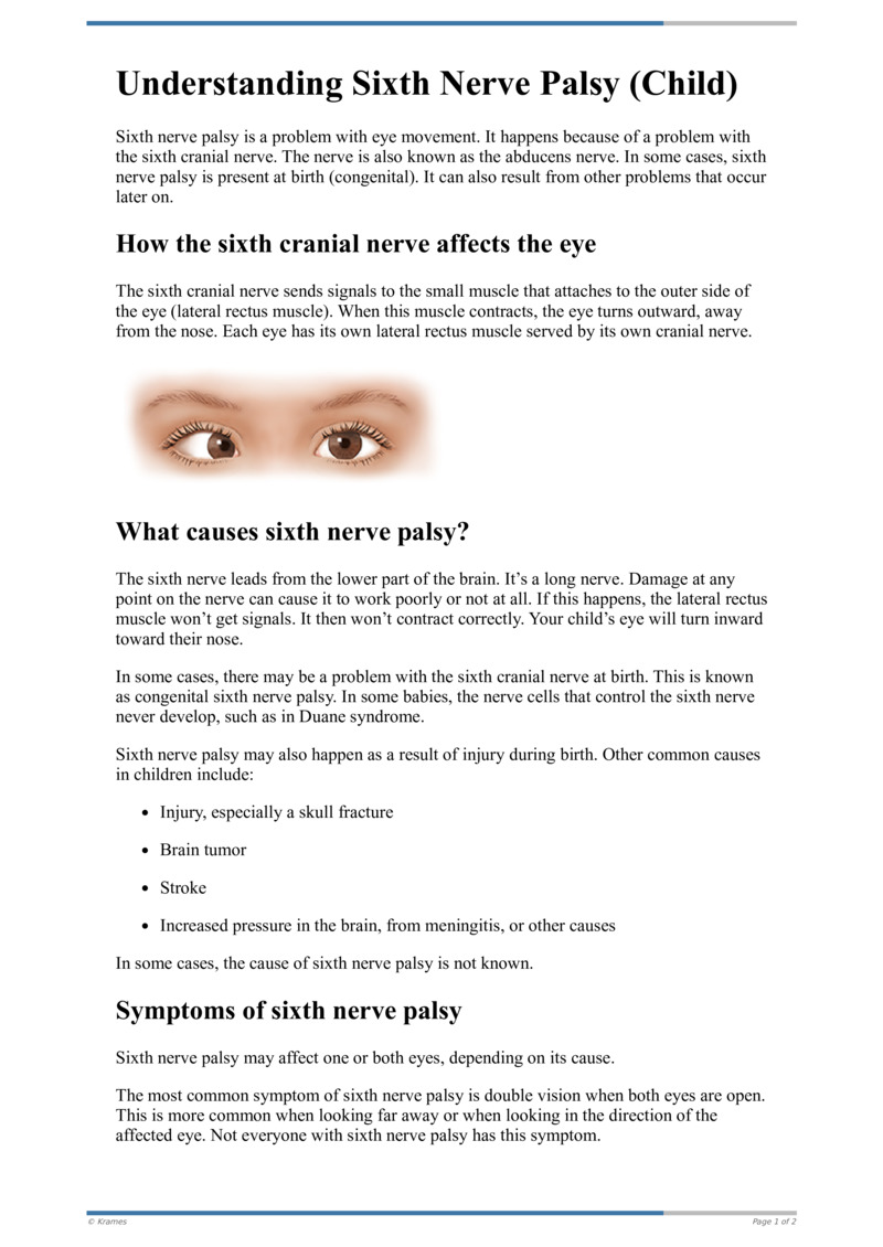 Text - Understanding Sixth Nerve Palsy (Child) - HealthClips Online
