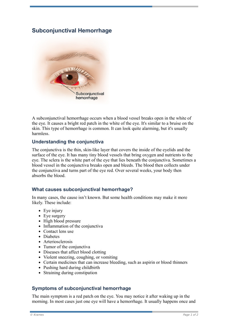 Pdf Subconjunctival Hemorrhage Healthclips Online