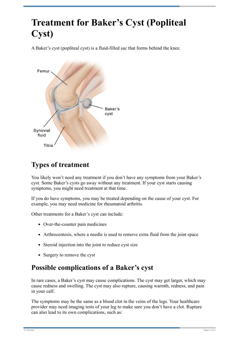 Text - Treatment for Baker's Cyst (Popliteal Cyst) - HealthClips Online