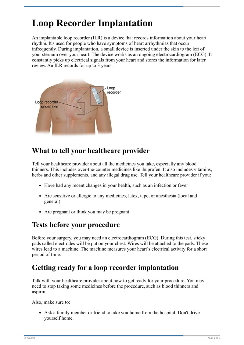 Text Having Loop Recorder Implantation HealthClips Online