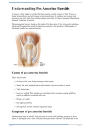 Understanding AC Joint Sprain