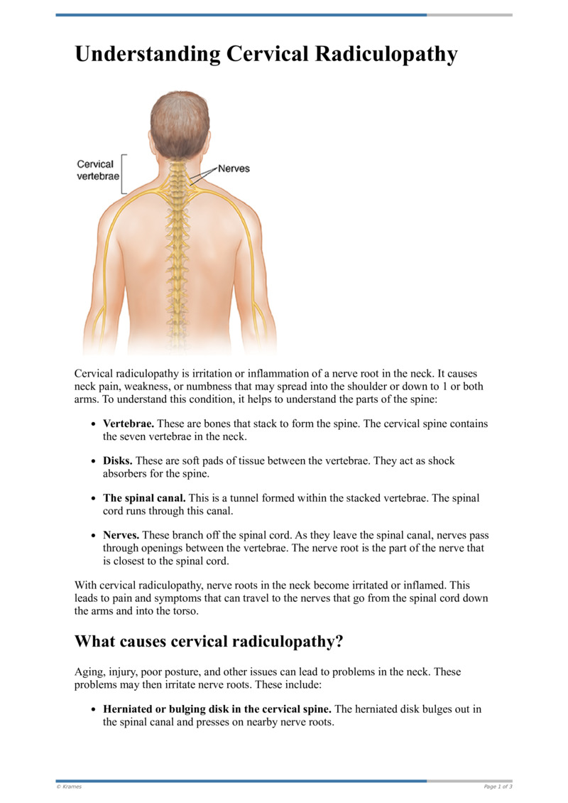 Text Understanding Cervical Radiculopathy Healthclips Online 1361