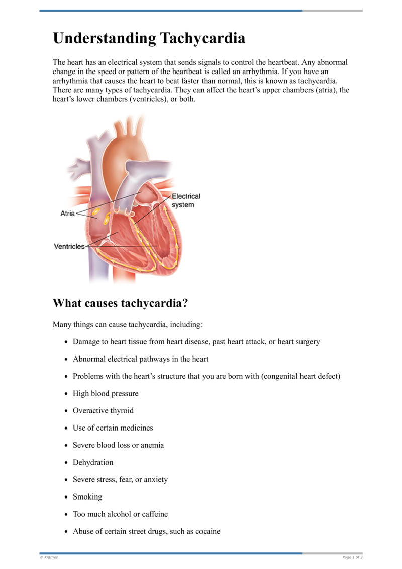 Text - Understanding Tachycardia - HealthClips Online