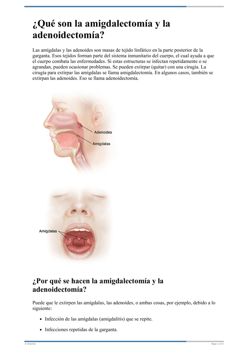 Poster image for "¿Qué son la amigdalectomía y la adenoidectomía?"