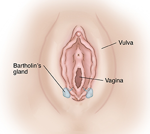 Text - Understanding Bartholin Cyst and Abscess