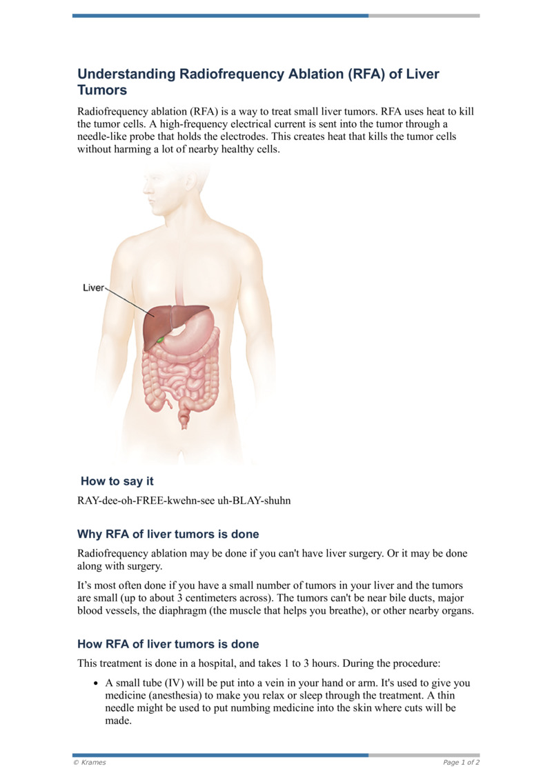 PDF Understanding Radiofrequency Ablation (RFA) of Liver Tumors