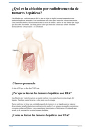 Thumbnail image for "¿Qué es la ablación por radiofrecuencia de tumores hepáticos?"