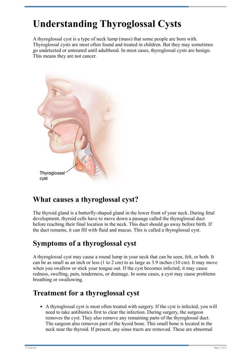 Text - Understanding Thyroglossal Cysts - HealthClips Online