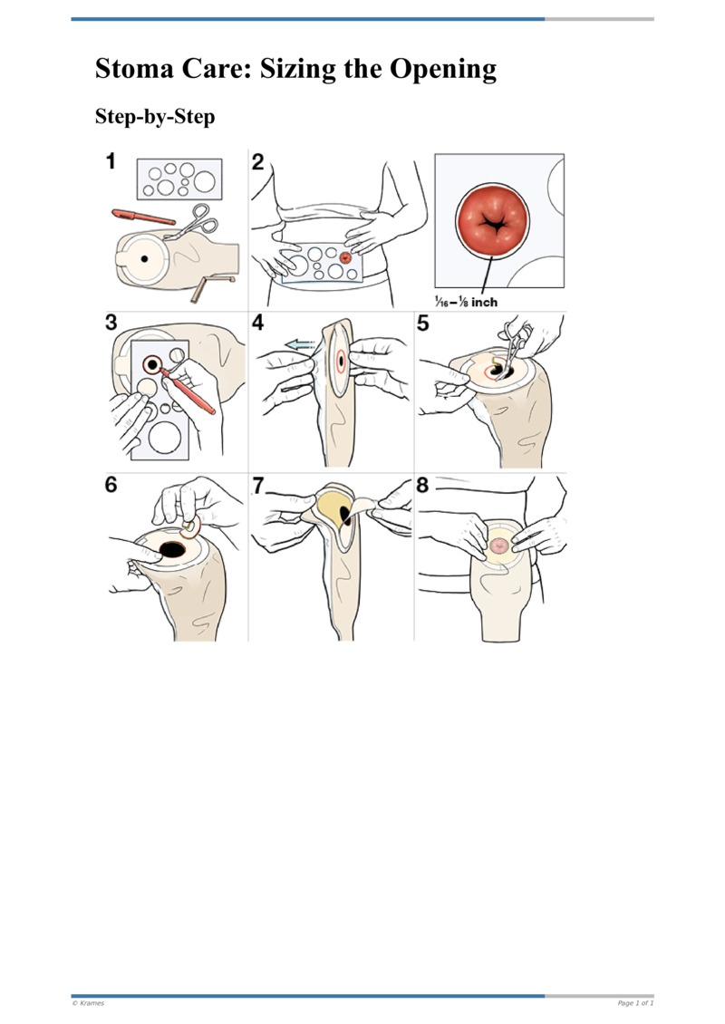 Text StepbyStep Stoma Care Sizing the Opening HealthClips Online