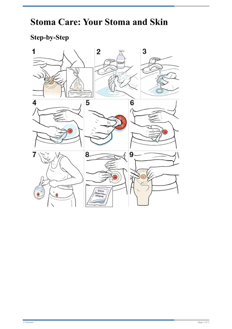 Text - Step-by-Step: Stoma Care: Your Stoma And Skin - HealthClips Online