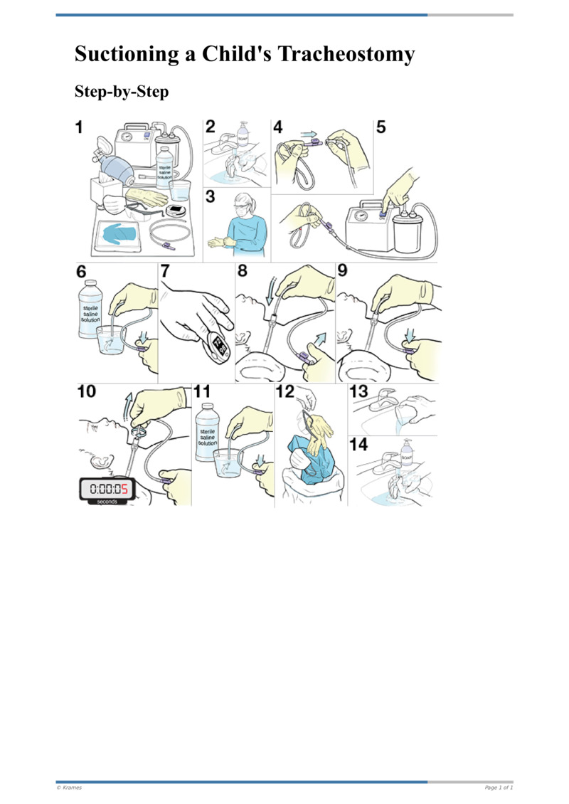 Text StepbyStep Suctioning a Child's Tracheostomy HealthClips Online