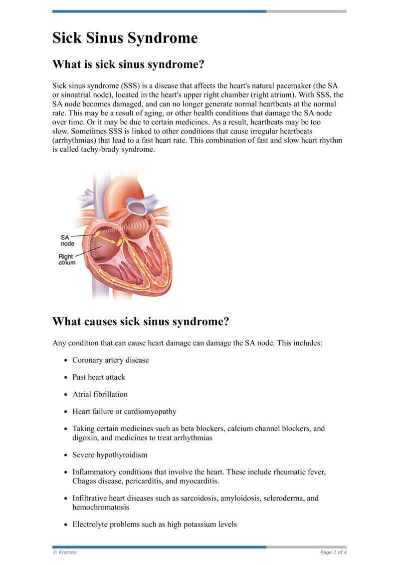 Text Sick Sinus Syndrome HealthClips Online