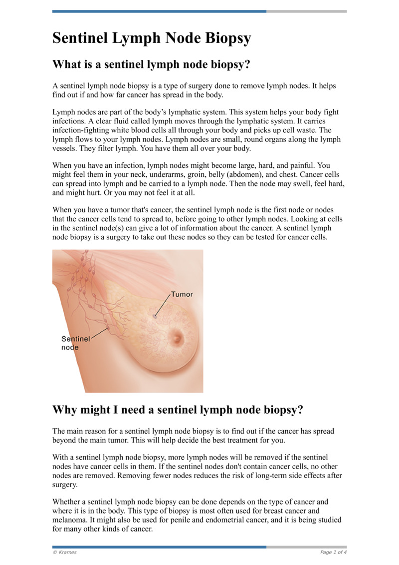 PDF Sentinel Lymph Node Biopsy HealthClips Online