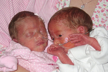 Thumbnail image for "Profile: Twins in the NICU"