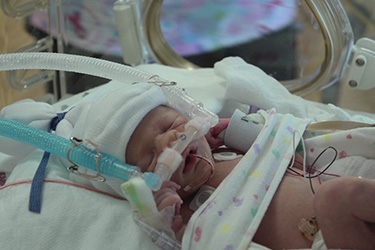 Thumbnail image for "Las afecciones pulmonares de mi bebé"