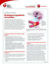 Thumbnail image for "Hablemos sobre el ataque isquémico al cerebro"