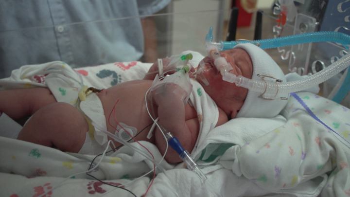 Video - Welcome to the NICU - HealthClips Online