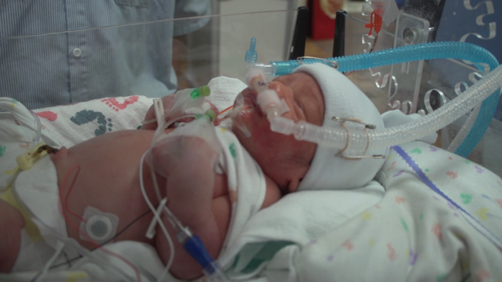 Video - The Risk of Infection in the NICU - HealthClips Online