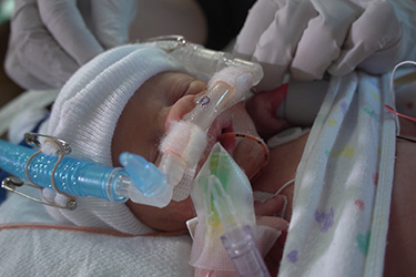Thumbnail image for "¿Qué es la presión positiva continua en las vías respiratorias  (CPAP) y cómo se usa?"
