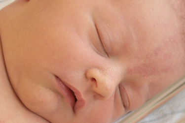 Thumbnail image for "Newborn Skin Care"