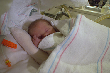 Thumbnail image for "Premature Newborn Care: Reflexes"