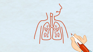 Thumbnail image for "¿Qué es la Bronquitis?"