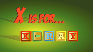 Thumbnail image for "X-Rays Explained"