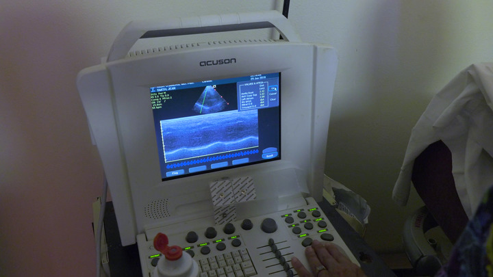 Video - What is an Echocardiogram (Heart Ultrasound)? - HealthClips Online