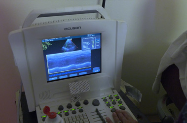 Thumbnail image for "What is an Echocardiogram (Heart Ultrasound)?"