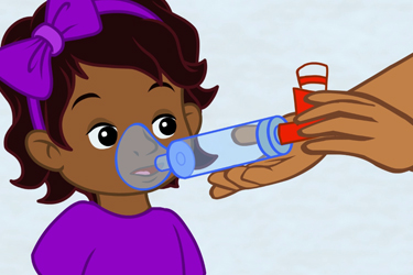 Thumbnail image for "How to Use Your Metered Dose Inhaler (MDI) with a Mask and Spacer"