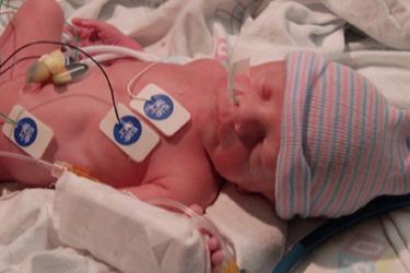 Thumbnail image for "Cuidando a tu bebé prematuro"