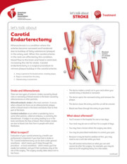 Thumbnail image for "Let's Talk About Carotid Endarterectomy"