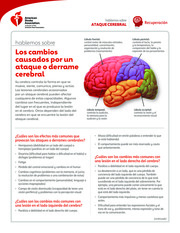 Thumbnail image for "Hablemos sobre los cambios causados por un ataque cerebral"