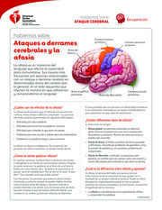 Thumbnail image for "Hablemos sobre ataques cerebrales y afasia"
