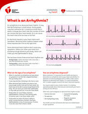 Thumbnail image for "What is an Arrhythmia?"