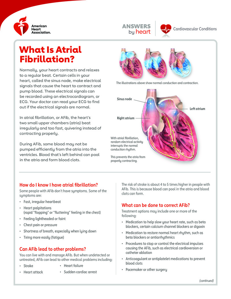 Text - What Is Atrial Fibrillation? - HealthClips Online