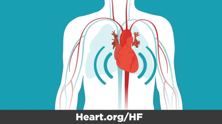 Video - Know the Symptoms of Heart Failure - HealthClips Online